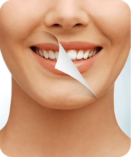 Teeth Whitening | Neighbourhood Dental | General & Family Dentist | Red Deer