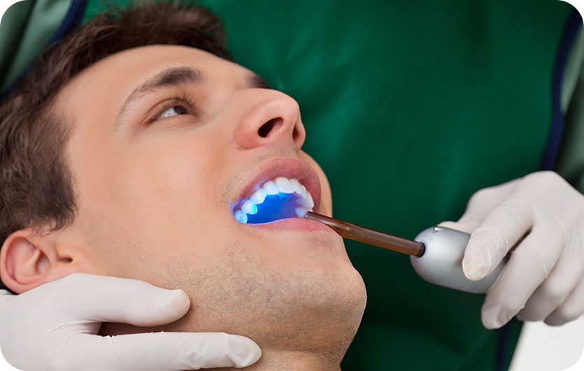 Cosmetic Tooth Bonding | Neighbourhood Dental | General & Family Dentist | Red Deer